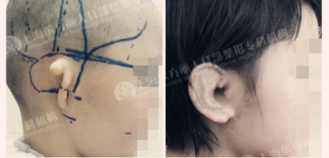 耳部畸形找麻烦,该怎么办