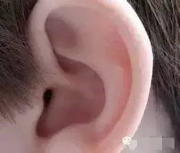 招风耳矫正手术多少钱?有副作用吗